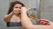 5 أسباب شائعة لتساقط الشعر.. تعرف عليها
