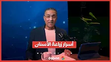 مخاطر محتملة أم علاج مضمون؟ كشف أسرار زراعة الأسنان.. مع الدكتور صلاح عبد الفتاح في بودكاست العيادة