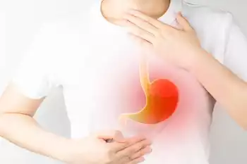 5 مشروبات تساعد على منع الارتجاع المعدي