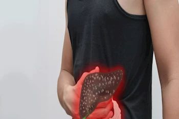 علامة في بطنك تدل على أن كبدك في خطر.. صحتك في رمضان