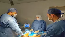 إجراء عملية دوالي الساقين بتقنية التردد الحراري بـ"جراحات اليوم الواحد" برأس البر