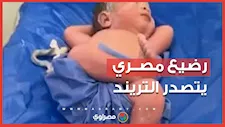 طبيب مصري يوثق وضعية طريفة لرضيع حديث الولادة تحصد ملايين المشاهدات