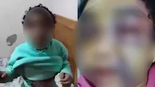 "أبوس إيديكم رجعوني بيت عمي".. حكاية طفلة الإسكندرية ضحية تعذيب والدها