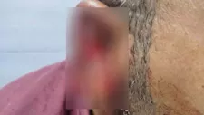 محامي بالمنوفية يكشف كواليس تعرضه لاعتداء وحشي من سيدة: "قفزت على رقبتي وقطعت أذني"