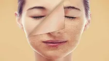 أمراض يمكن التعرف عليها من خلال الوجه.. علامات قد تكشف مشكلات صحية كامنة