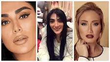 هدى قطان ليست الأولى.. فنانات تعرضن لـ "التشوه" بسبب إجراءات تجميلية