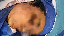 "28 طعنة وسكينة في الجمجمة".. والد "شهد" يروي تفاصيل تعرضها للطعن على يد خطيبها من المعصرة
