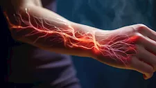  4 أعراض قد تكشف إصابتك بالتهاب الأعصاب 