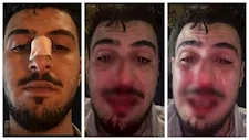 العريس واثنان آخران.. التحقيق مع المتهمين بالتعدي على صاحب فيديو زفة دهشور