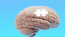 لماذا ننسى بعض الذكريات بسهولة ونحتفظ بأخرى؟