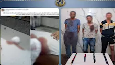 معركة شوارع بالأسلحة البيضاء بين أشقاء تنتهي ببتر كف أحدهم بسبب الميراث