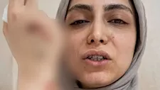 طبيبة الأسنان المعتدى عليها: المريضة طلبت الأسنان بعد الخلع واللوائح تمنع التسليم