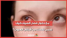 مع دخول فصل الصيف كيف تحمي نفسك من أمراض العيون ؟
