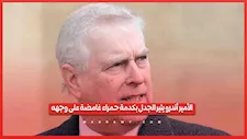 الأمير أندرو يثير الجدل بكدمة حمراء غامضة على وجهه