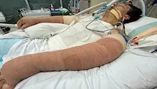   رجل كاد أن يفقد حياته بسبب مكنسة كهربائية .. فما القصة؟ 