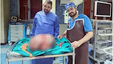 بعد استئصال ورم ضخم يزن 24 كيلو.. تكريم فريق طبي بجامعة المنيا