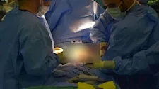 ما حكم فصل التَّوأمين المُلتصقين لو في ذلك موت أحدهما؟.. الإفتاء تجيب 