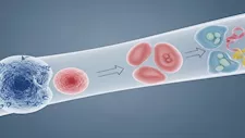  كيف يؤثر الالتهاب المزمن على الجسم والدماغ؟.. أطعمة قد تقلل الخطر