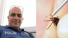 لدغة قرادة تُنهي حياة رجل بعد 3 أيام من إصابته.. ماذا حدث؟ 