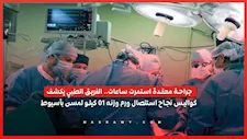 جراحة معقدة استمرت ساعات.. الفريق الطبي يكشف كواليس نجاح استئصال ورم وزنه 10 كيلو لمسن بأسيوط