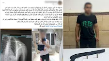 "طلقة طائشة وسط الشارع".. كواليس إصابة عابر سبيل في مشاجرة بالأسلحة بـ