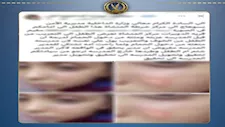 حرق وجه طالب بقداحة.. الداخلية تكشف تفاصيل واقعة مدرسة سوهاج