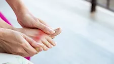 النقرس.. ما أسبابه ومن الفئات الأكثر عرضة للإصابة به؟