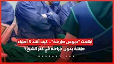  ابتلعت "دبوس طرحة".. كيف أنقذ 3 أطباء طفلة بدون جراحة في كفر الشيخ؟