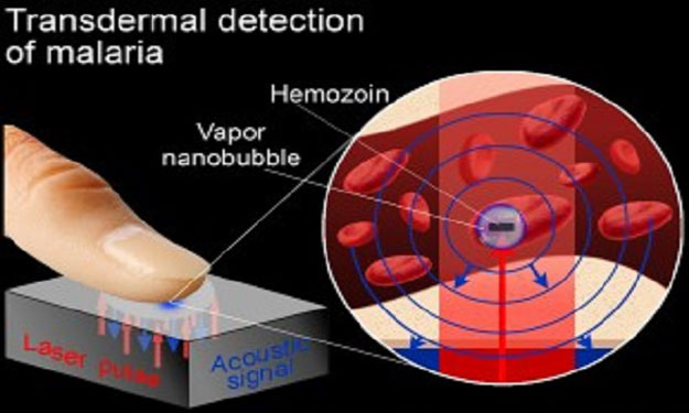وسيلة جديدة لكشف الملاريا في ثوان