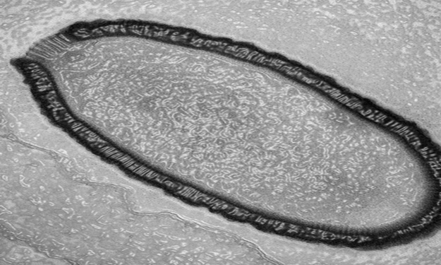 علماء يعيدون إحياء فيروس بعد موته بـ30 ألف عام.. و