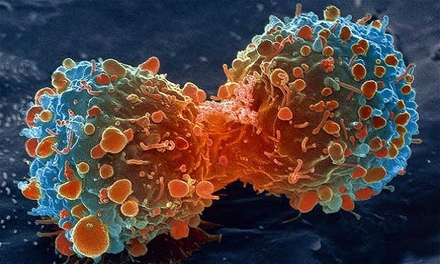 علماء روس يكتشفون فيروسًا يقضي على السرطان