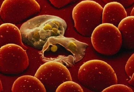 طفيليات الملاريا تصل إلى نخاع العظام