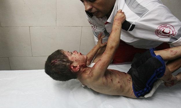 معاناة أحد أطفال غزة الذين أصيبوا في القصف الإسرائ