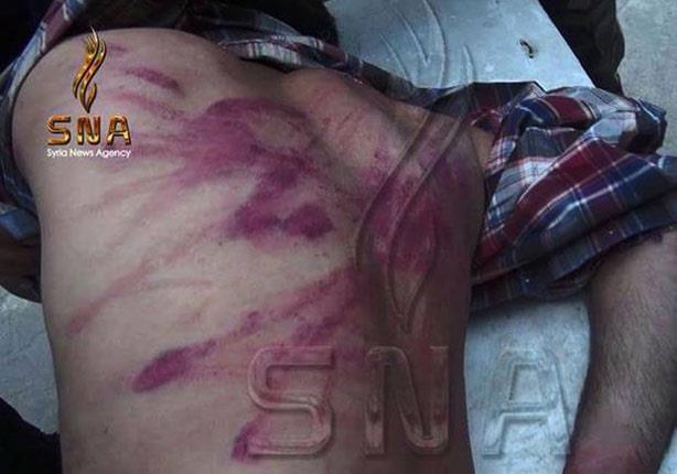 ناشط سوري يصف خطفه وتعذيبه على يد جبهة النصرة