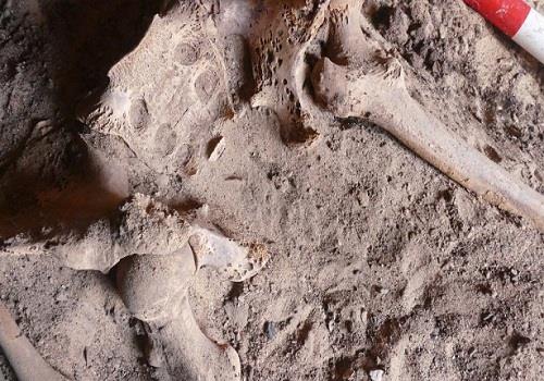 الكشف عن أقدم إصابة بسرطان الثدي في مصر القديمة