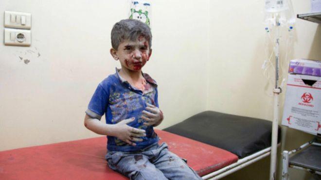 طفل سوري ناج من قصف في سوريا