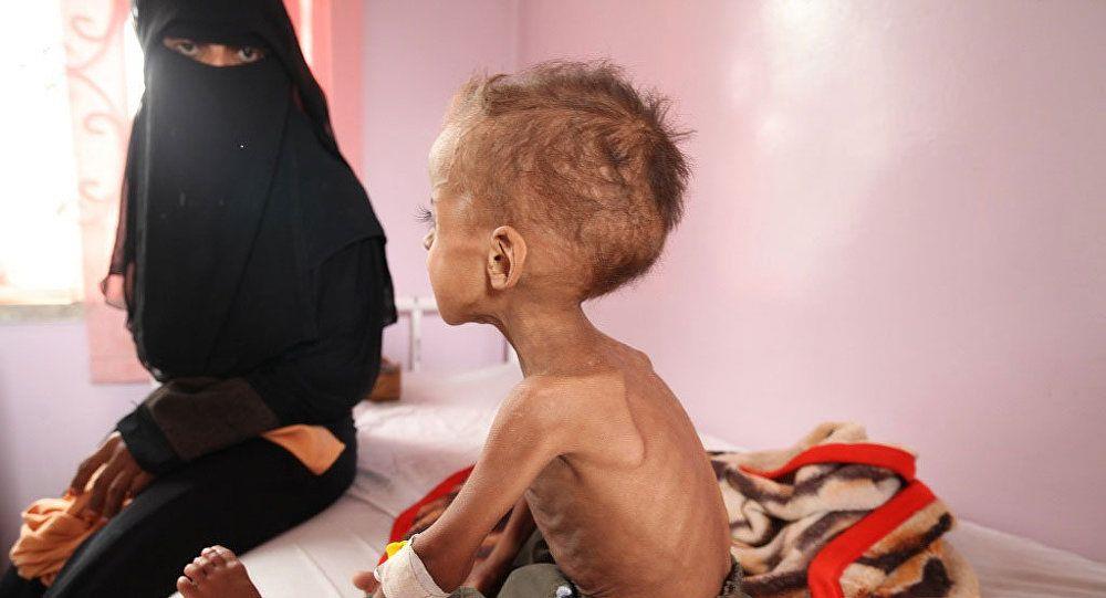  ارتفاع حالات الإصابة بالكوليرا في اليمن