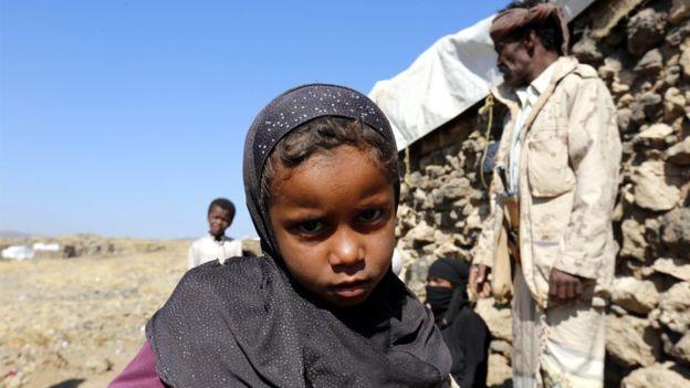 ملايين اليمنيين بحاجة إلى مساعدات غذائية