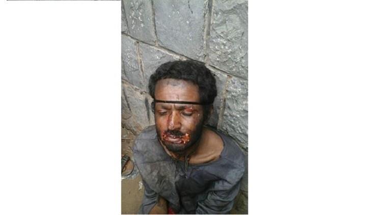القبض على مصاص دماء في اليمن