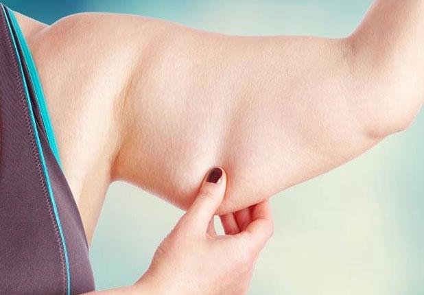 كيفية علاج ترهل الجلد بعد فقدان الوزن الزائد