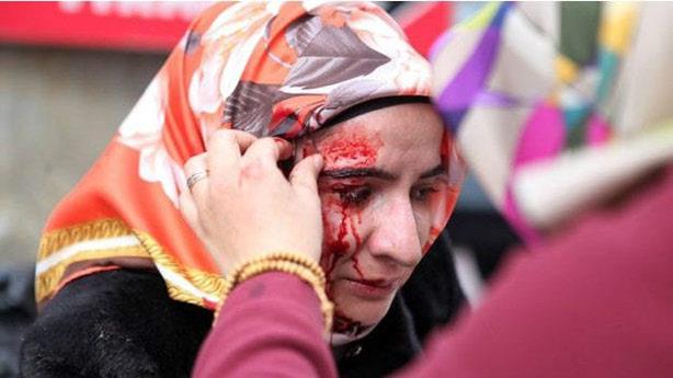  صورة وزعتها صحيفة "زمان" تقول إنها لمتظاهرة أصيبت