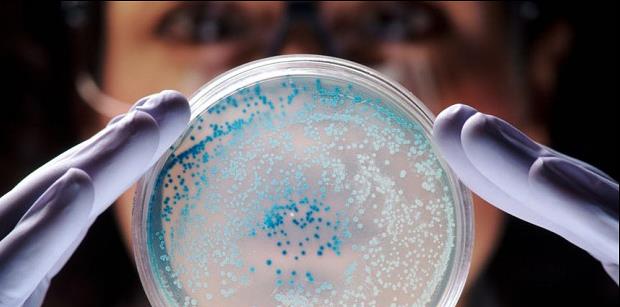 اكتشاف بكتيريا مقاومة للعقاقير في الولايات المتحدة
