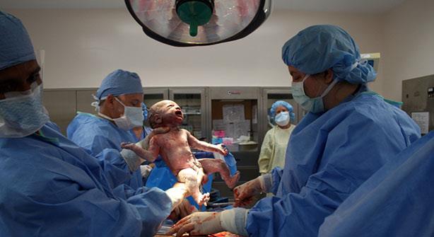 زيادة معدلات الولادة القيصرية في مصر