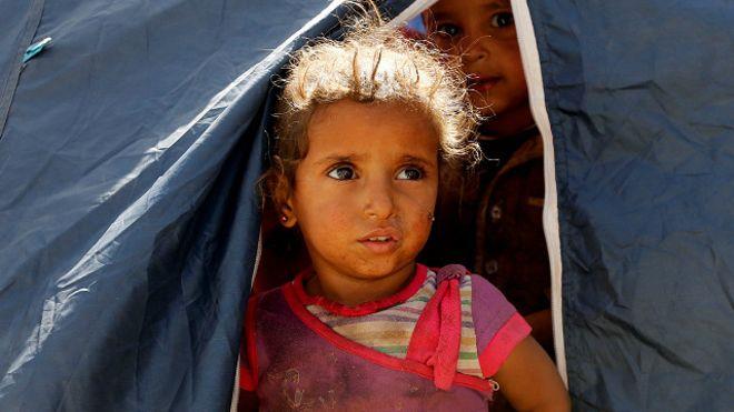 دفع النزاع كثيرا من اليمنيين، وبينهم أطفال، إلى ال