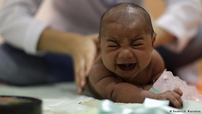 طفل مُصاب بفيروس زيكا