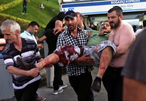 حصيلة القتلى والمصابين في تركيا