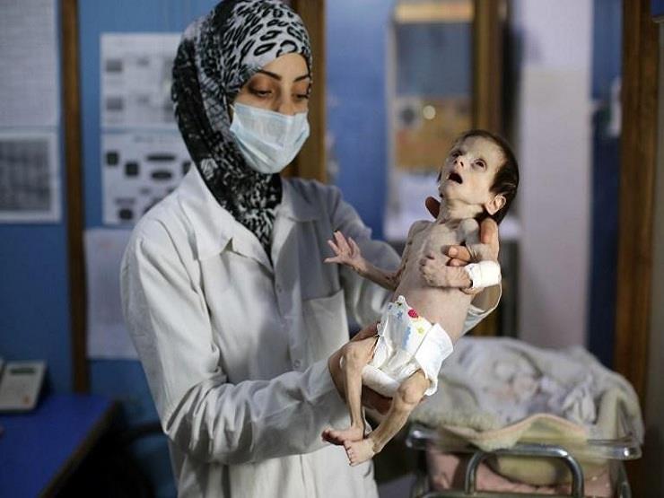 وفاة الرضيعة السورية سحر ضفدع