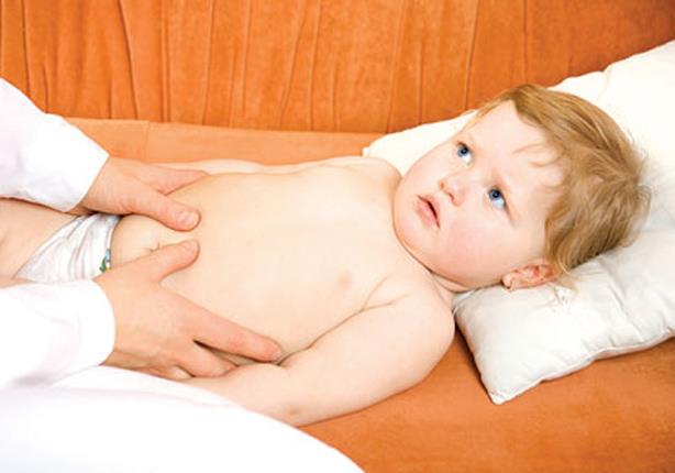 طريقة جديدة لعلاج آلام البطن عند الأطفال