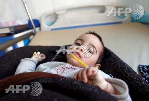 طفل يمني مصاب بالكوليرا (أ ف ب)
