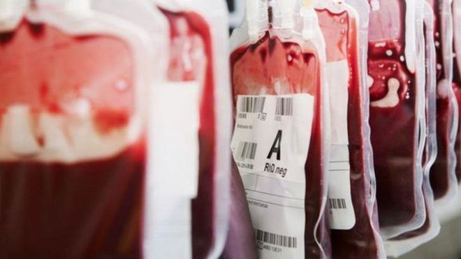 آلاف المرضى البريطانيين حقنوا بمنتجات دم من الخارج